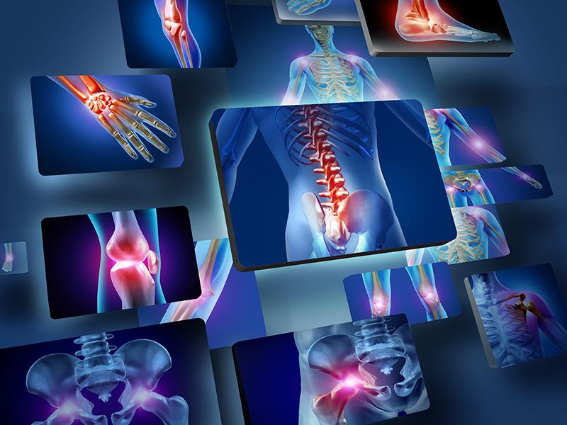 A new and refined injectable treatment for musculoskeletal disorders - bioscaffold properties of collagen and its clinical use. Part 2